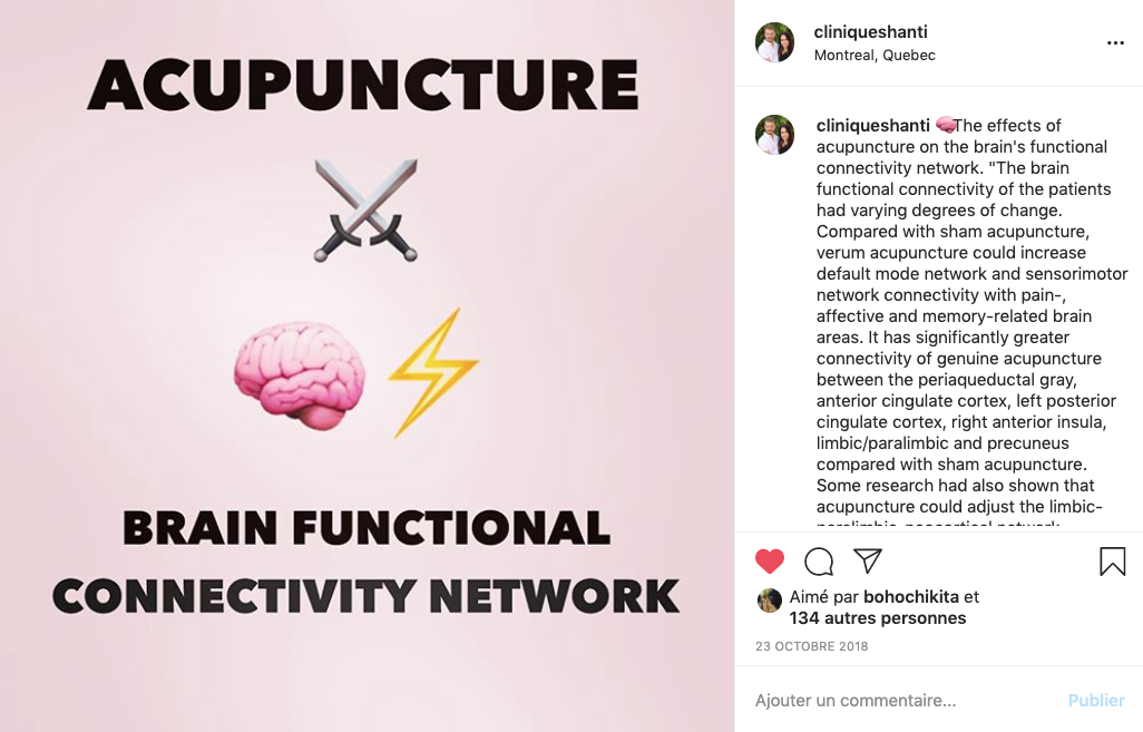 Acupuncture's effects on the brain's functional connectivity network

